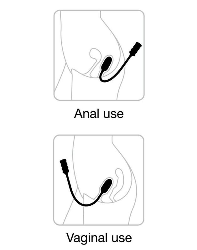 SO2948 Виброяйцо Dorcel Deep Explorer, подходит для вагинальной и анальной стимуляции, мощное